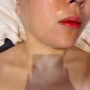 서면중학교 | 서면 이중턱관리 잘하는곳 뷰티디아망 1회차 솔직후기