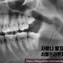 서울프리벤치과의원 이미지