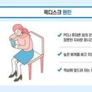 목디스크 초기 원인 목통증 관리법 도수 약물 이미지