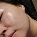 라온메디케어 이미지