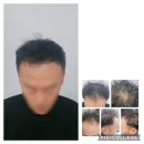삭발청년아카데미