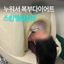 앤바이오 | 종로3가 다이어트 스킨앤숲칼프 바이오포톤 슬림케어 복부 후기