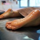 보고 발관리
