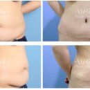 아틀리에성형외과의원 이미지