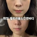 화정 엘트리움스킨앤바디에서 G-ZERO Shadow Shine 프로그램으로 피부광채 찾은 후기