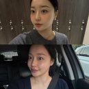 생기365 - 서구 운천로 213 | 논현역 피부과 올리디아 365 솔직 후기 :: 콜라겐부스터 팔자주름과 앞볼 볼륨 고민 해결