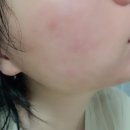 트러블케어 시카앰플 에이치큐랩 시카흔적앰플 후기