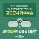 명안과의원 | 초고도근시라섹에 퍼스널아이즈 라섹 적용한 밝은명안과 26년 노하우