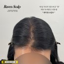 레이븐스칼프 이미지
