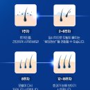 진화약품 | 탈모샴푸 판매1위,로게인폼 6개월 후기, 정말 머리가 날까?