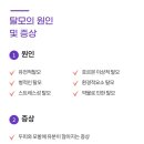 센스모 이미지