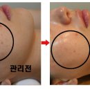 쎌 에스테틱 네이버블로그