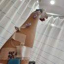 세븐일레븐 강릉아산병원점 | 서울아산병원 제왕절개 2인실, 수술비용