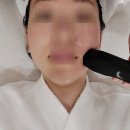 인천구월동피부관리 엘레나이젠 더마튠 리프팅&amp;예스필 후기