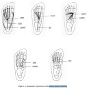 발의 내재근 training방법과 함께..Evaluation and Retraining of the Intrinsic Foot Muscles for Pain Syndromes Related to Abnormal Control of Pronation 이미지