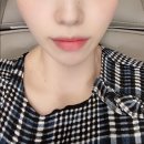 샤넬주사 후기+인셀덤으로 물광피부 유지하는 꿀팁 대방출
