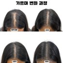 이후 | 3개월 지나도 유지되는 하남 미사두피문신, 제이후샵 후기