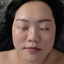 려에스테틱 | 김포 피부관리 구래동 이연에스테틱 올리지업 관리와 수분 데콜테 추가 후기