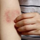 구대한의원 이미지