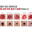 (주)퍼슨헬스케어 이미지