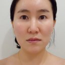 프레아 에스테틱 | 포항 피부관리 웨딩케어 또간집 브이라인맛집 프레아에스테틱