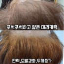 뷰티앤두피 이미지