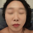 바라봄에스테틱 | 부천 웨딩관리 경락 추천, 에스테티아 신중동역점 리얼후기