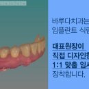 덴탈아트치과기공소 이미지