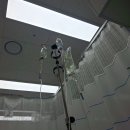 의료법인구의료재단 구병원 | 30대 초반 대장 큰 용종(2cm) 제거 / 대구 구병원 대장내시경