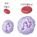 나이 들수록 비타민 B12 결핍 위험 커진다 이미지