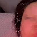 아름턱한의원 이미지