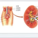 급성 신우신염[acute pyelonephritis] 이미지