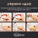 산소 덤