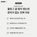 글림애드