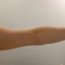 리하 | 💆🏻‍♀️ 연산동피부관리 리하에스테틱 팔뚝관리 후기