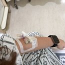 손 다한증 수술 후기