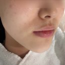 공활 | 서면피부관리샵 악건성 수분 초음파관리 후기 | 데자뷰메디스킨 부산점