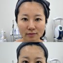 수피부관리 | 마산 교방동피부관리 수뷰티 셀린비 이벤트 후기