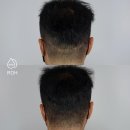 프로스칼프부산 이미지