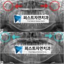 디비퍼스트