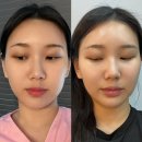 붓기 싹! 입꼬리 업! 에너지 순환으로 얼굴 라인 정리 끝, 호평동왁싱 ‘아나덴 남양주호평점’ 후기