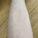 강남JC성형외과의원 이미지