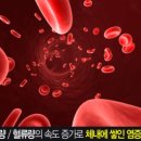스타링 이미지