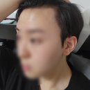 머리를가꾸는사람들 - 남동구 | 청주 헤어라인 반영구 잘하는곳 / 남자 헤어라인 반영구 리터치로 M자 채운 후기 🫦