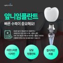 강남역치과추천 앞니임플란트후기 좋은 곳