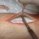 유어타임성형외과의원 | [유어타임 보험진료 근황] 왜 성형외과 전문의에게 봉합을 해야할까요