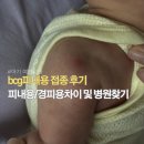 심낭골 네이버블로그
