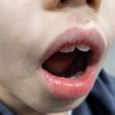 지축 응급실 대신 이엠365의원에서 아이상처 치료 받았어요.