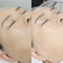엠(M)메디칼(DG) | 대전유성피부관리 엠뷰티24 스킨 플래닝 잘하는 곳 방문 후기