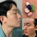 대우약국 | 이마거상 실리프팅 이마 스킨보톡스 6개월 후기 (전후,효과,부작용)